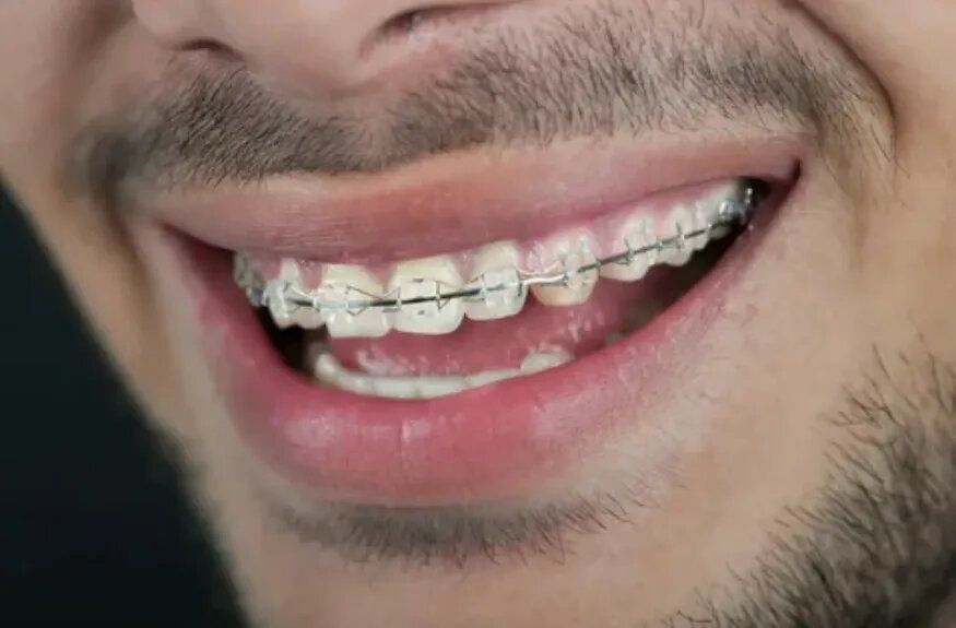 ��� ������� ������ �� ������ � �����: ���� � ����������