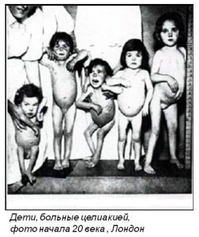 Как целиакия и безглютеновая диета изменили современное питание