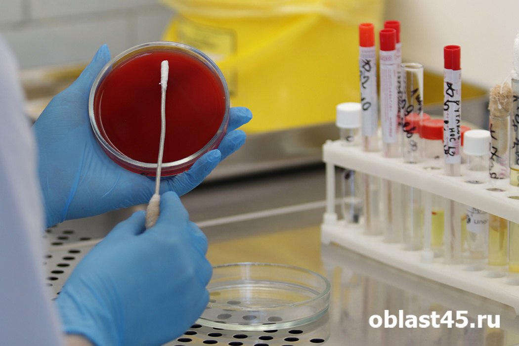 За год показатель заболеваемости ВИЧ в Зауралье снизился почти на 11%