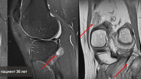 � ������ ��������� �� ����� �������� ������������ ��������� ��������������� ��� ��������� ��������� ������-������������� ��������