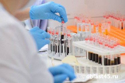 ����� � 2 ���� �������� ������� �������������� ������������� ���������� � ��������