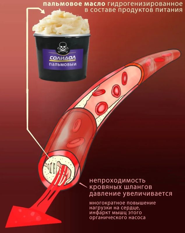 Пальмовое масло в продуктах: почему важно читать состав перед покупкой Пальмовое масло в продуктах: почему важно читать состав перед покупкой