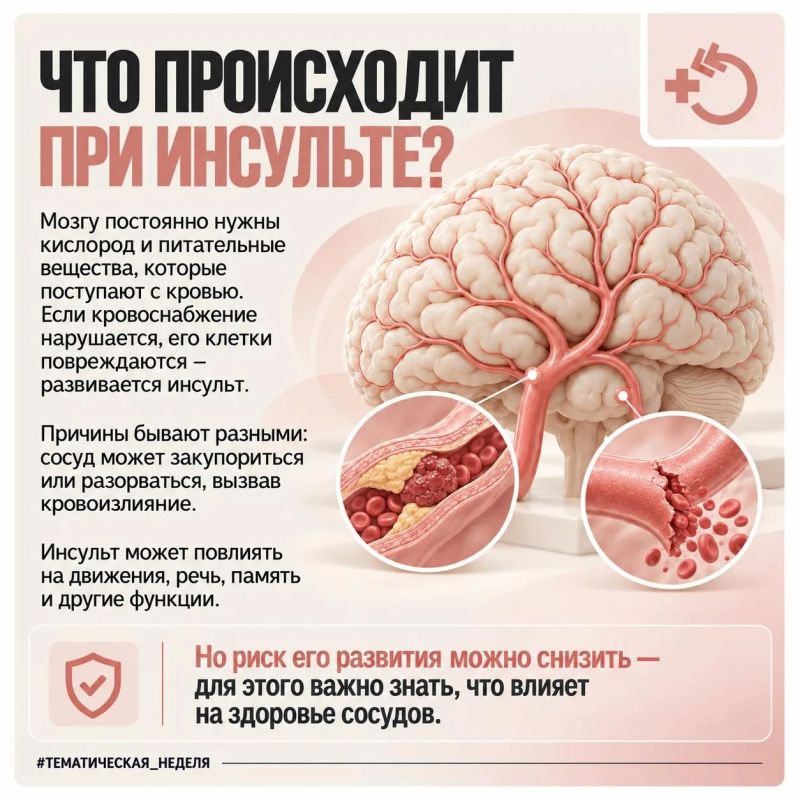 «Стоп! Инсульт не выбирает время!» — 10 минут после ужина могут спасти жизнь «Стоп! Инсульт не выбирает время!» — 10 минут после ужина могут спасти жизнь